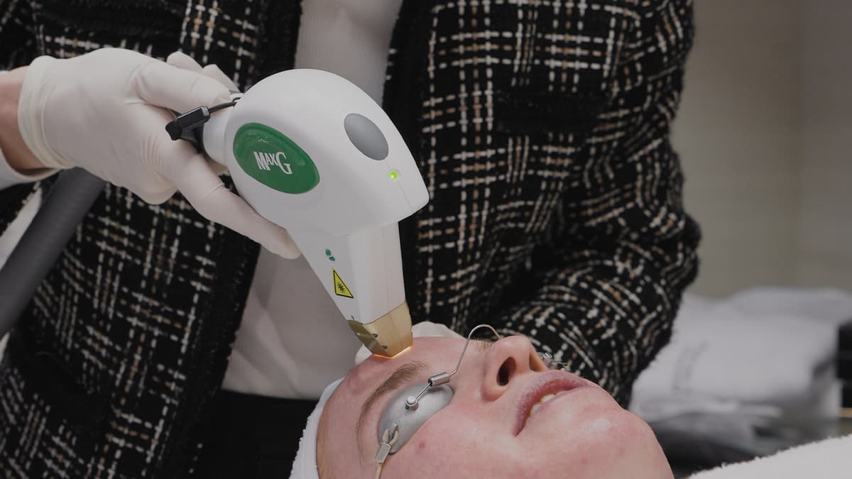 Laser-treatment-forehead