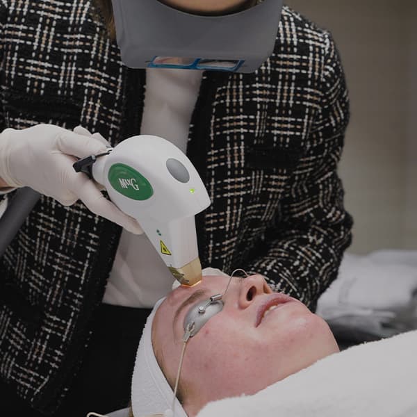 picosure-Laser-treatment-forehead