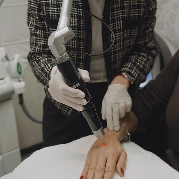 laser-hand-treatment