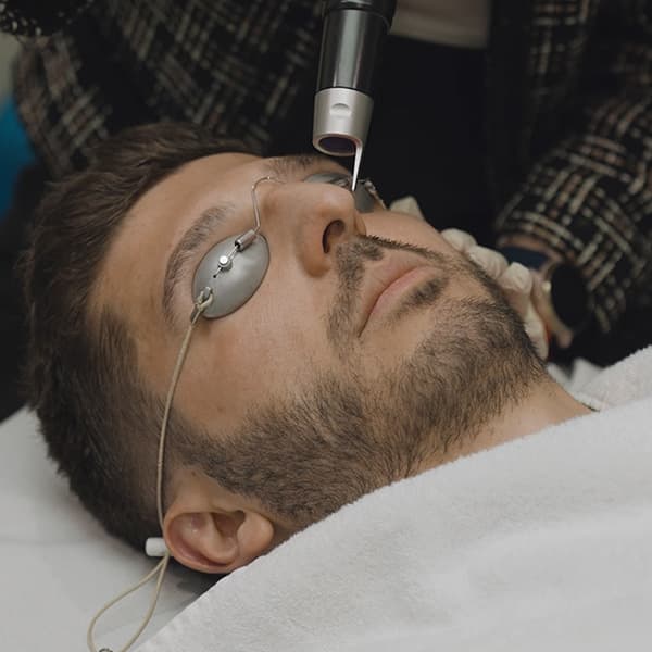 Picosure-man-eye-protection