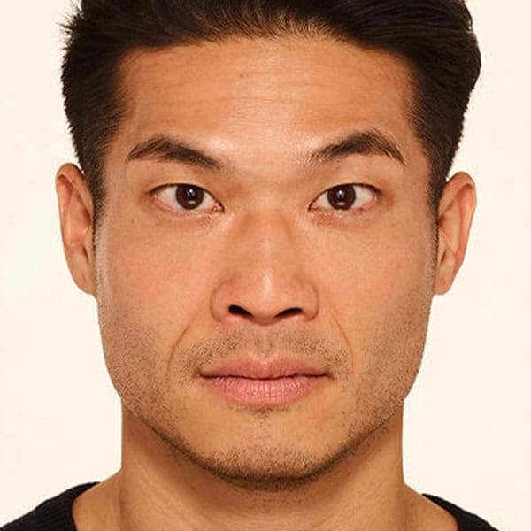 after-botox-treatment