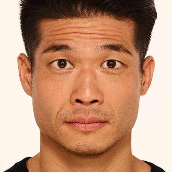 Andrew-botox-before