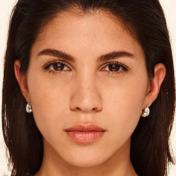 Nicole-after-botox