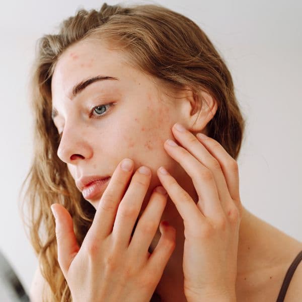 problematic-skin-mirror