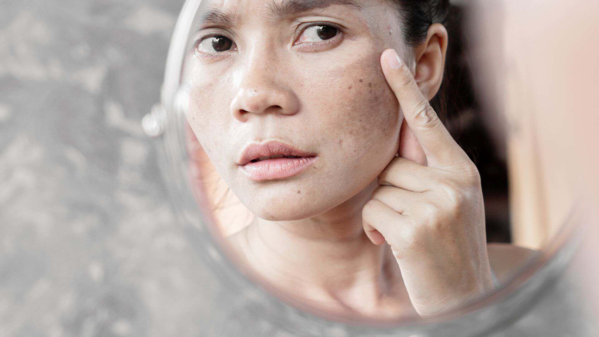 age-spots-banner