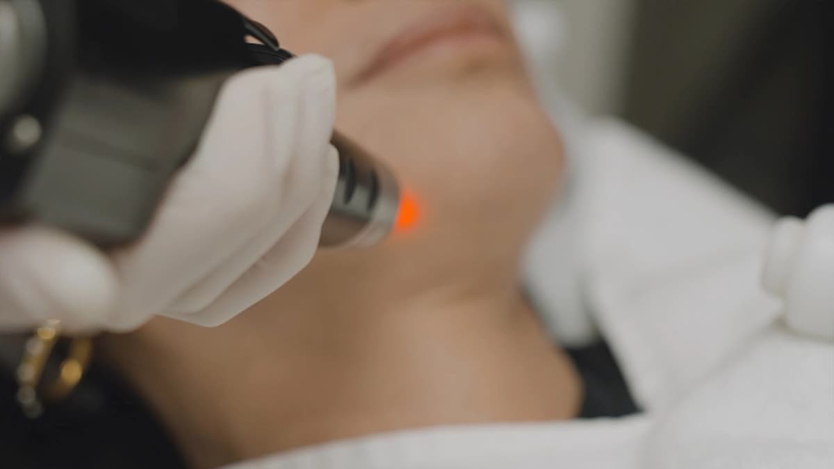 picosure-pico-laser