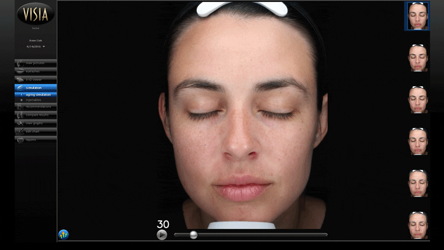 VISIA 7 advanced ageing skin analysis comparison