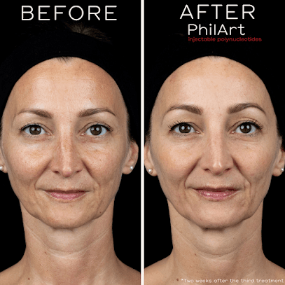 Polynucleotides-before-after-face