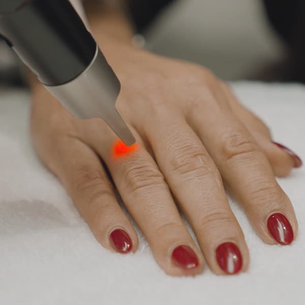 laser-hand-treatment-finger-skin