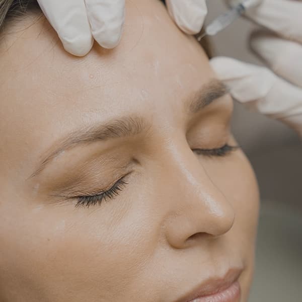botox-forehead