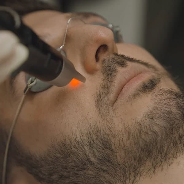 Picosure-laser-cheek-skin