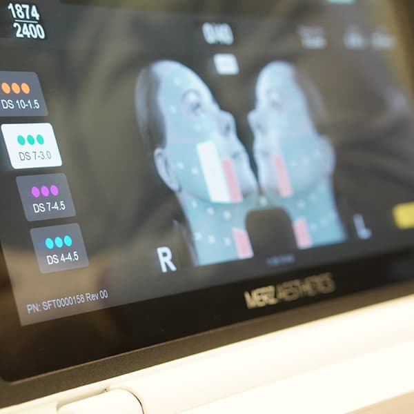 Ultherapy-drjoney-screen