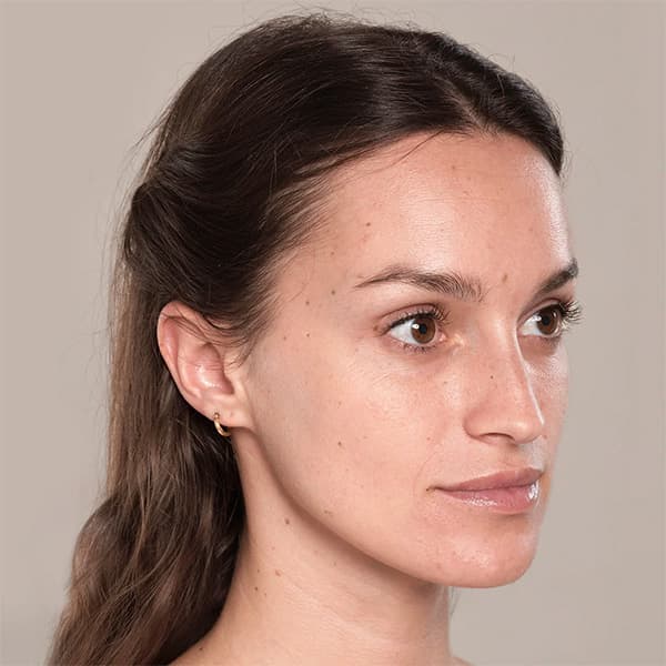 texoane-treatment-before