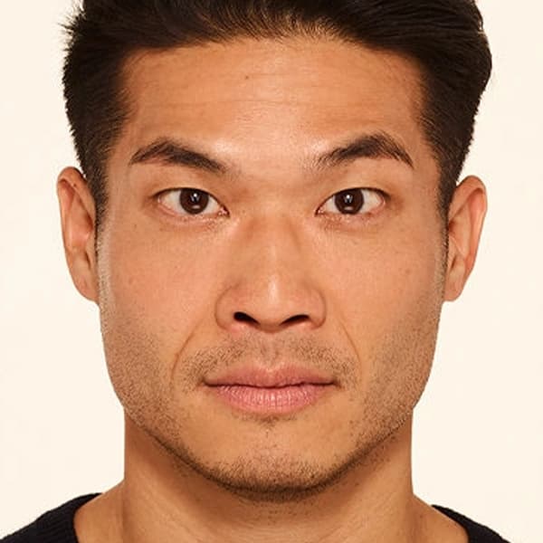 after-botox-treatment