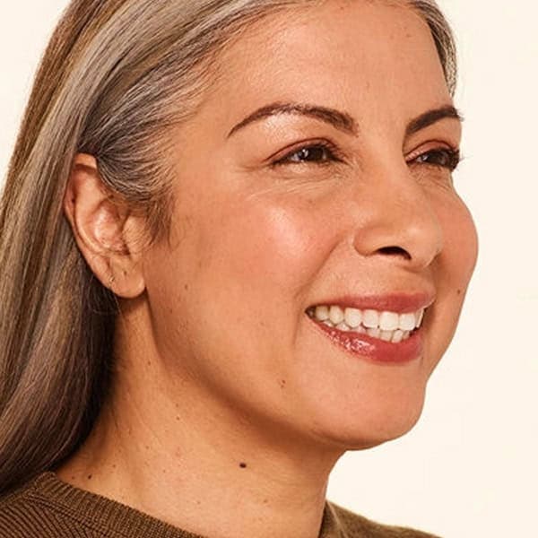 Delfina-after-threequarter-smile