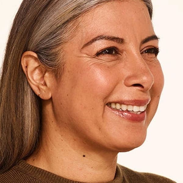 Delfina-before-threequarter-smile