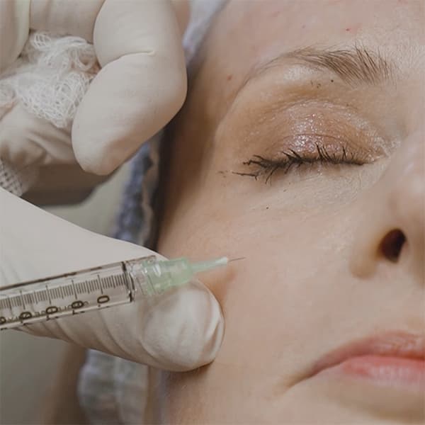 skinvive-injection-needle