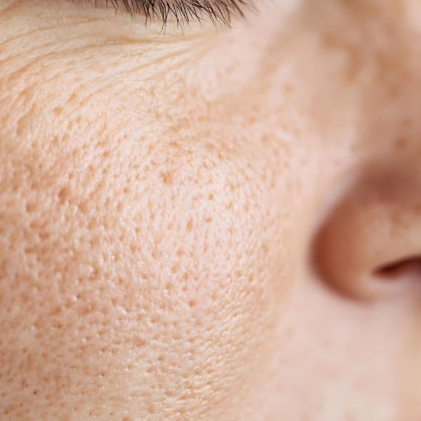 open-pores-close