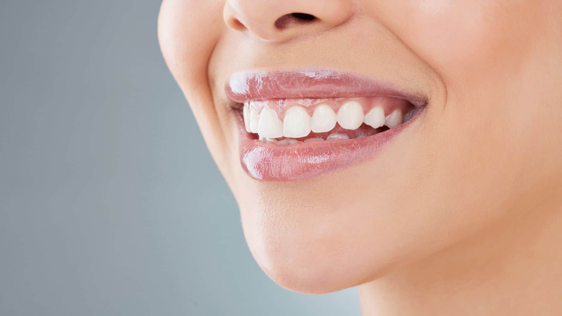 Gummy-smile-banner