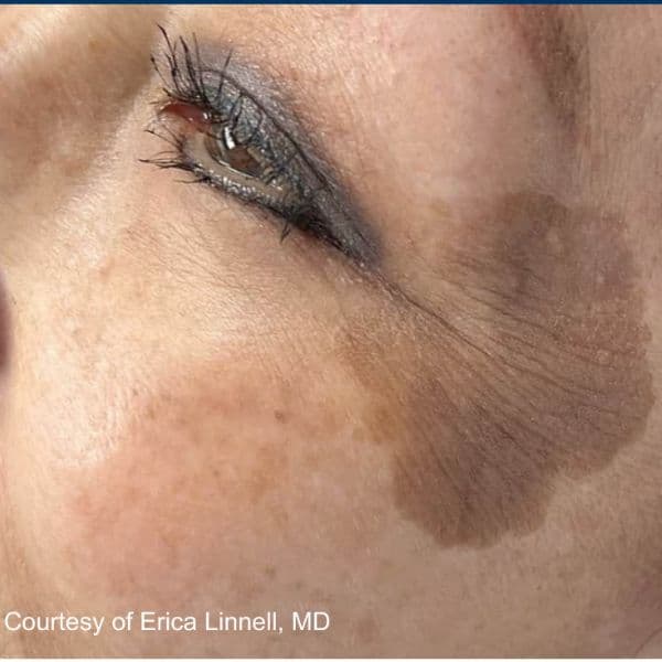 3Dmiracl-clear-before