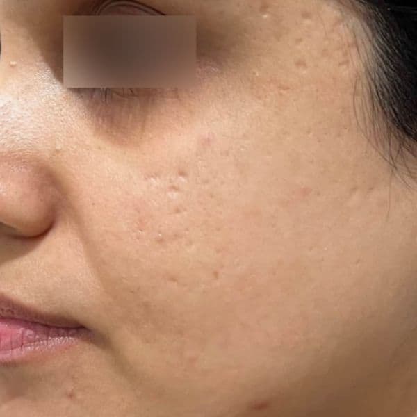 3DMIRACL-Before