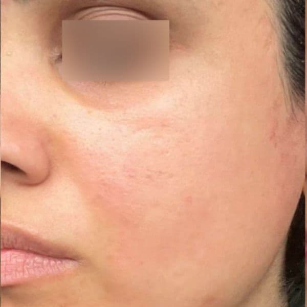 3DMIRACL-After-6-days