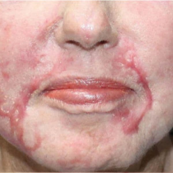 Scarring-before-ultraclear